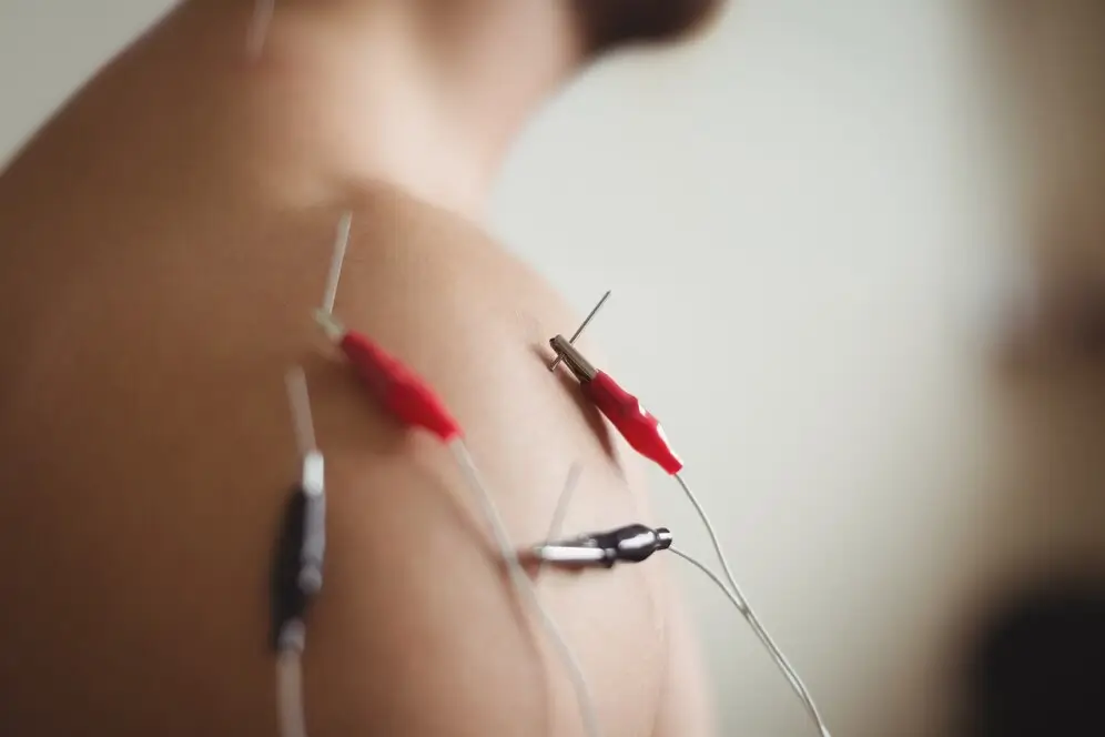 acupuncture for libido
