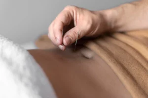 acupuncture for fertility near me