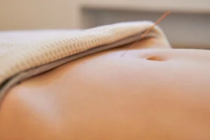 acupuncture near me