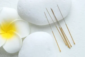 acupuncture near me for fertility