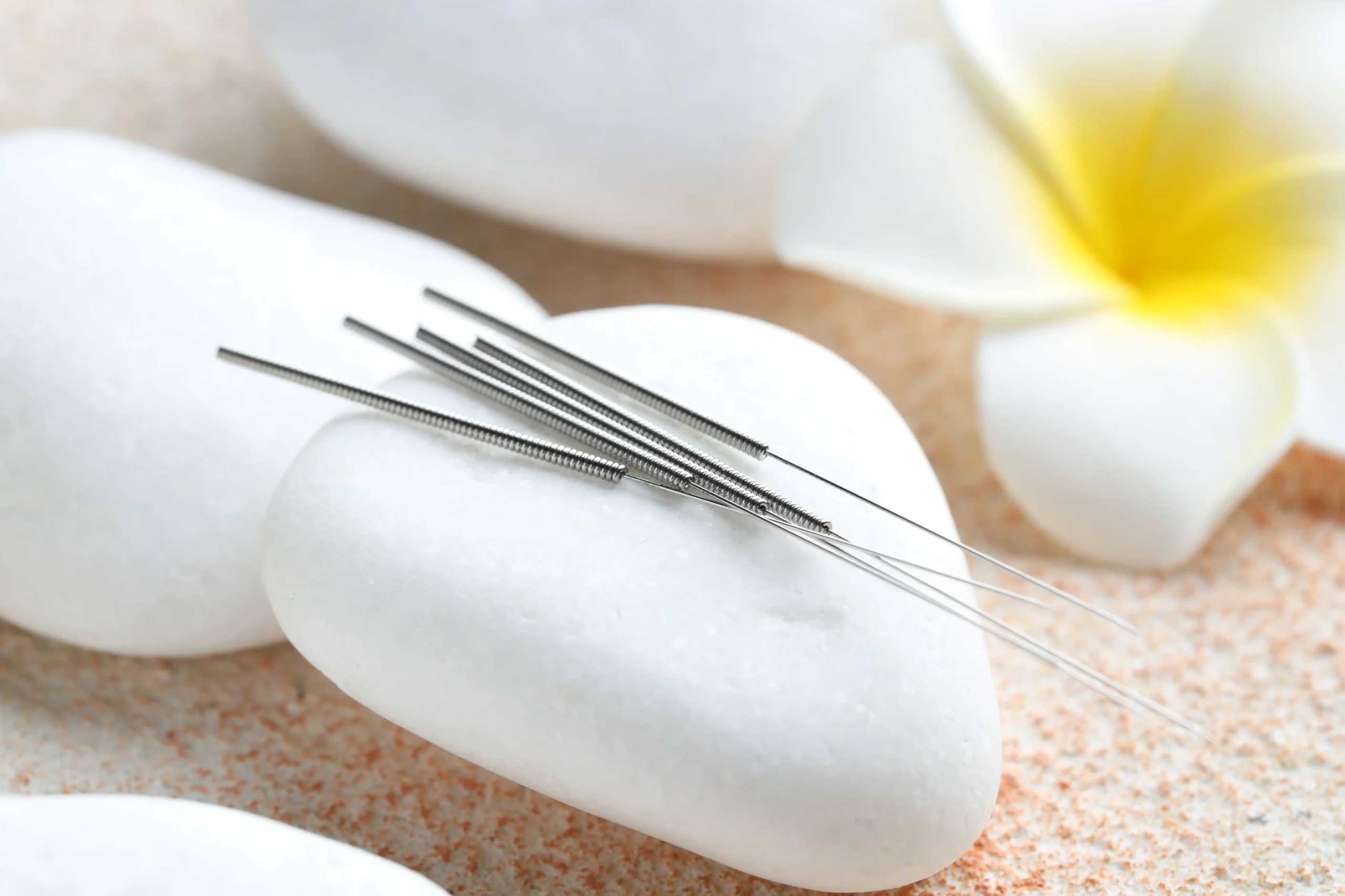 fertility acupuncture near me