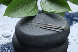 acupuncture before embryo transfer