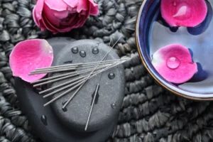 acupuncture for ivf