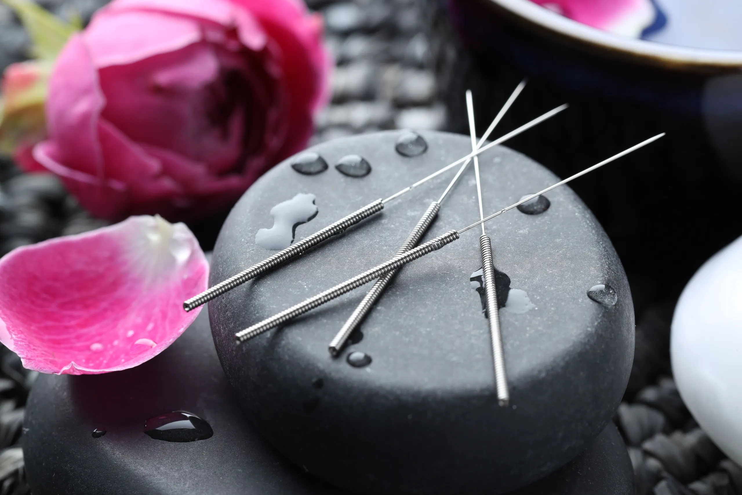 acupuncture for ivf near me