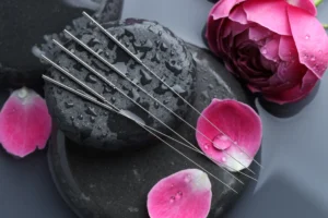 acupuncture ivf near me