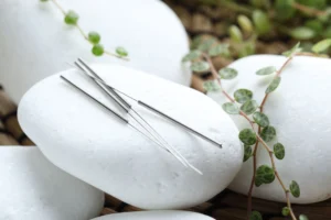 ivf acupuncture near me